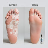 GermOut™ – Anti-Fungal & Anti-Odor Spray | Prevents Nail & Foot Infections